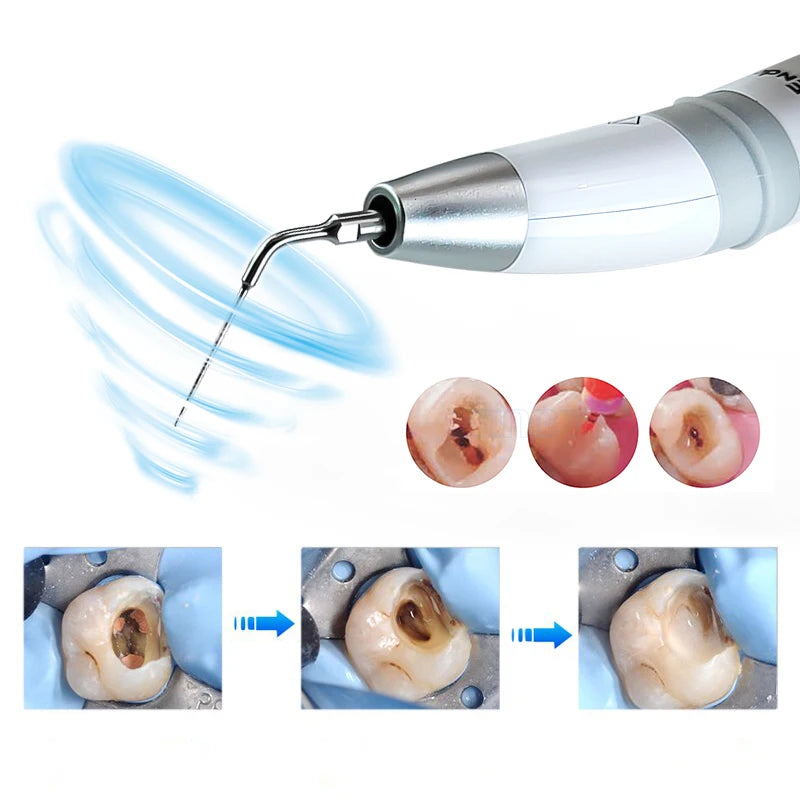 Woodpecker Endo 3 Dental UItrasonic Activate Device