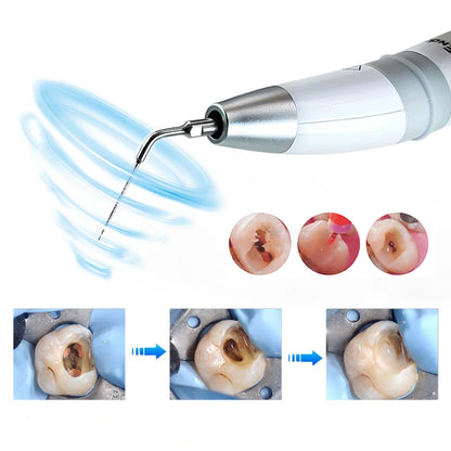 Woodpecker Endo 3 Dental UItrasonic Activate Device