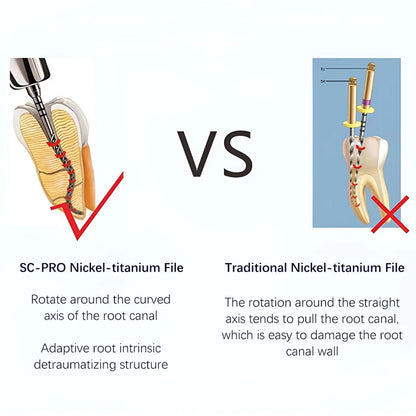 Coxo Sc Pro Limas Odontológicas Endo Limas Rotatórias Endodônticas para Terapia de Canal Radicular Instrumentos de Canal Radicular de Nitinol Ativado Termicamente